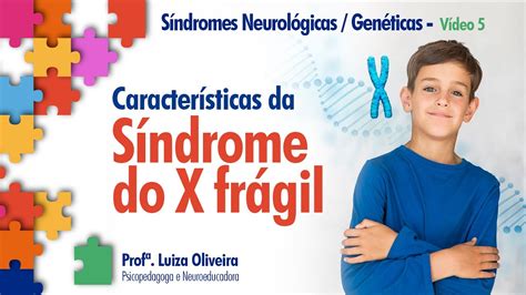 Síndrome Do X Frágil Cariótipo ROAREDU