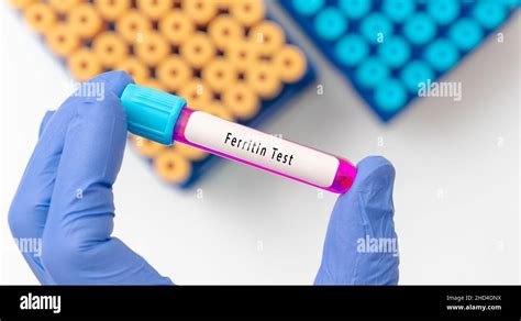 Ferritin Test Result With Blood Sample In Test Tube On Doctor Hand In