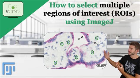 How To Select Multiple Regions Of Interest Rois Using Imagej Fiji