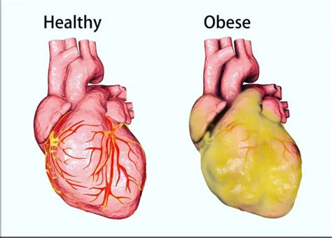 Signs Of Unhealthy Heart Anaaya Foods