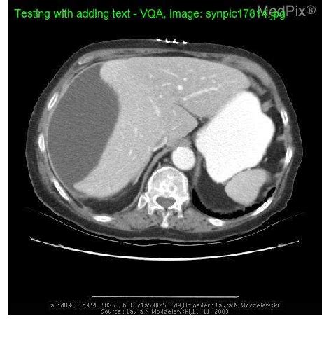 Figure 1 From Visual Question Answering VQA On Images With