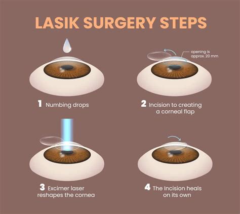 Lasek Vs Lasik What S The Difference Michigan Eye Institute