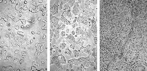 Photomicrographs Of RPMI 2650 Cells After One A Three B And Nine