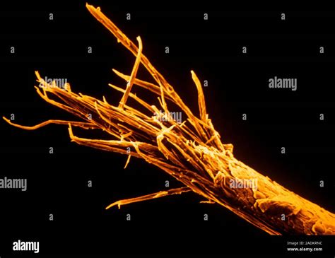 False Colour Scanning Electron Micrograph Sem Of A Human Hair With A