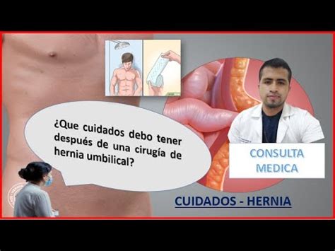 Qu Cuidados Debo Tener Despu S De Una Cirugia De Hernia Umbilical