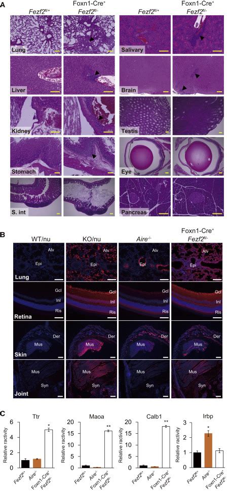 Fezf Orchestrates A Thymic Program Of Self Antigen Expression For