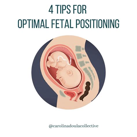 4 Tips For Optimal Fetal Positioning