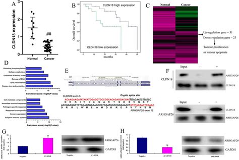 CLDN18 controls CLDN18 expression in gastric cancer cells. CLDN18 ...