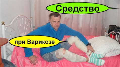 Варикозное расширение вен на ногах. Лечение варикоза в домашних ...