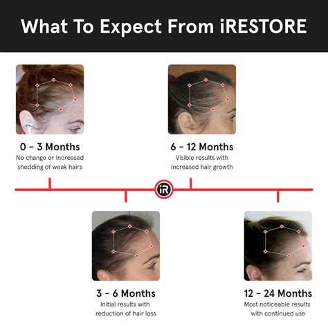 Irestore Laser Hair Growth System Egypt Vitamins