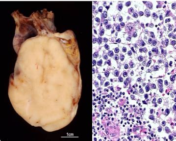 Pathology 2 Repro System Flashcards Quizlet