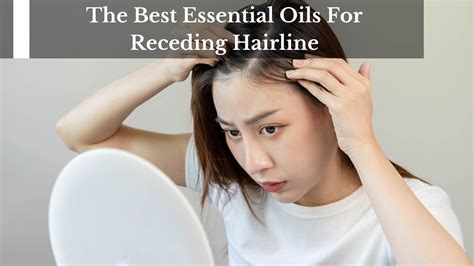 The Best Essential Oils For Receding Hairline