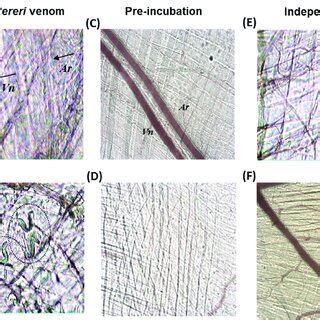 The antiserum neutralized the alterations in the microcirculation ...