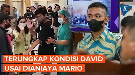 Saksi Ahli Beberkan Kondisi David Usai Dianiaya Mario Dandy YouTube