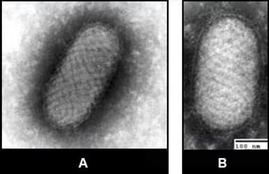 Negative Staining Electron Microscope Protocol For Rash Illness