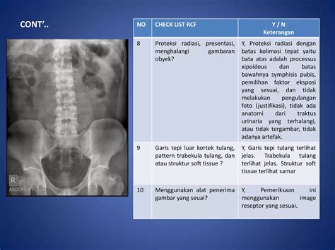 Ppt Kritisi Dan Evaluasi Radiograf Ivp Dan Cystografi Ppt