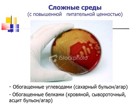 Питательные среды - презентация онлайн