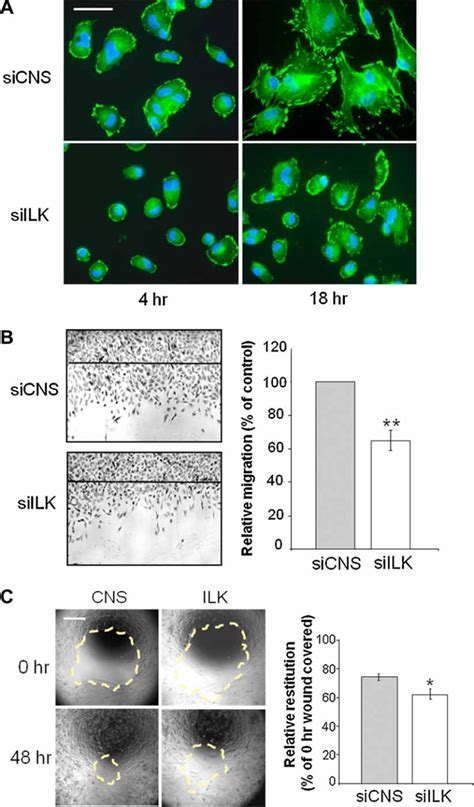 Knockdown Of Ilk Expression Inhibits Hiec Cell Spreading And Migration