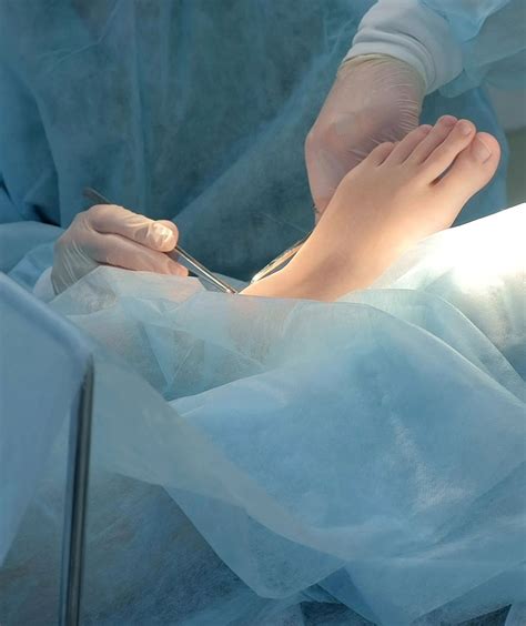 Ankle & Foot Surgeon Oconomowoc | Lake Country Surgical Podiatrist