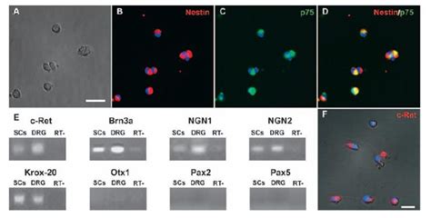 Egr2 Rt Pcr Gene Expression Assay Gxd