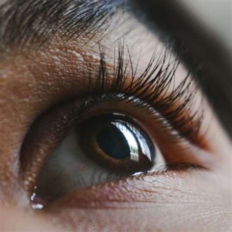 Understanding Blepharitis Symptoms Causes And Treatment