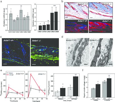 Extracellular Matrix Changes In Mutant Mice A Increased Transcript