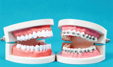 Services Shepparton Denture Clinic