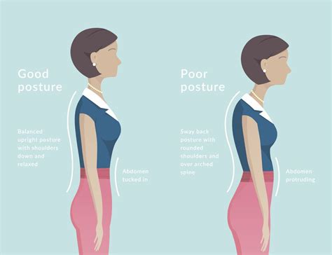 How To Reverse Slouching Posture