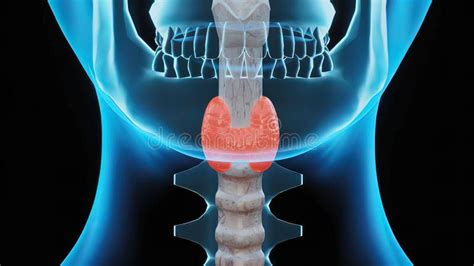 Nodular Goiter Occurs When The Thyroid Gland Does Not Produce Enough Thyroid Hormone For The