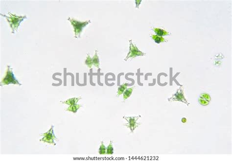 Freshwater Aquatic Plankton Under Microscope View Foto De Stock