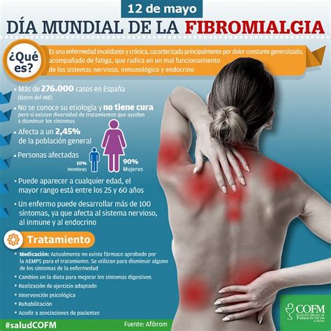 Aprender Sobre Imagem Fibromialgia Sintomas Fotos Br Thptnganamst