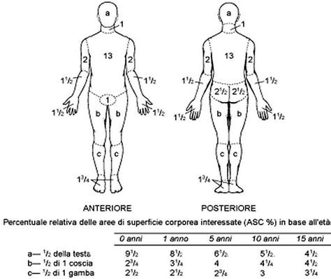 Calcolare La Superficie Di Una Ustione La Regola Del 9