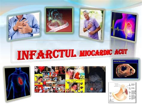 Ppt Infarctul Miocardic Acut Powerpoint Presentation Free Download Id 7411495