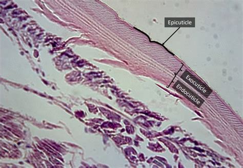 ZO010 Zoology Lab Quiz Lab 11 - Ecdysozoa Flashcards | Quizlet