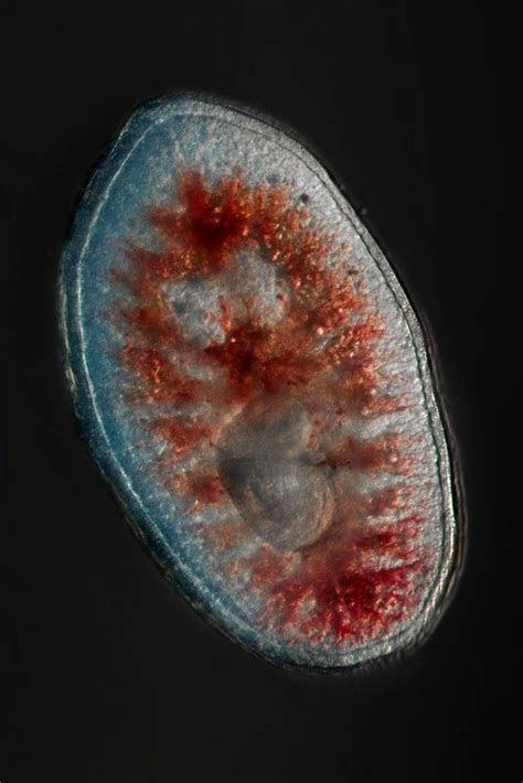 Planula Chroniques Du Plancton