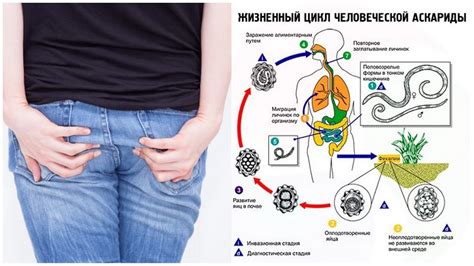 Life Cycle Of A Roundworm