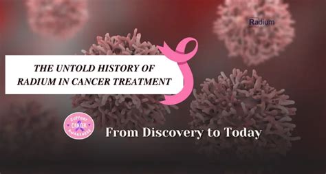 The History Of Radium In Cancer Treatment