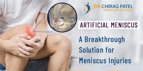 A Breakthrough Solution For Meniscus Injuries Joint Health