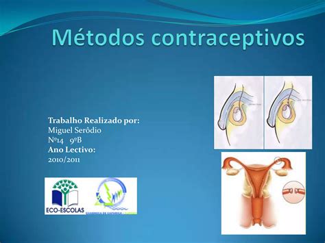 M Todos Contraceptivos Ppt