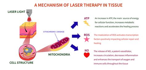 Laser Therapy Via Photobiomodulation For Musculoskeletal Pain In