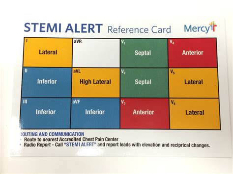 Best Way To Learn 12 Lead Ecg - Just For Guide