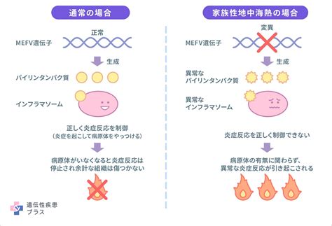 家族性地中海熱 遺伝性疾患プラス