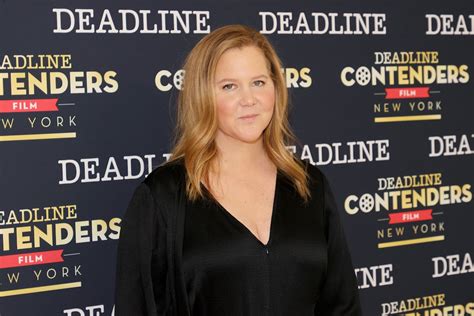 Amy Schumer Reveals Liposuction Results And Gets Candid About Battle