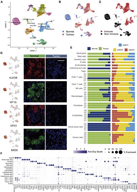 Single Cell Transcriptome Analysis Reveals Intratumoral Heterogeneity