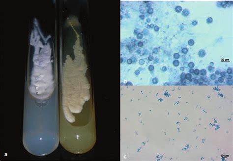 7 Macro And Microscopic Aspects Of Histoplasma Capsulatum Dimorphism Download Scientific