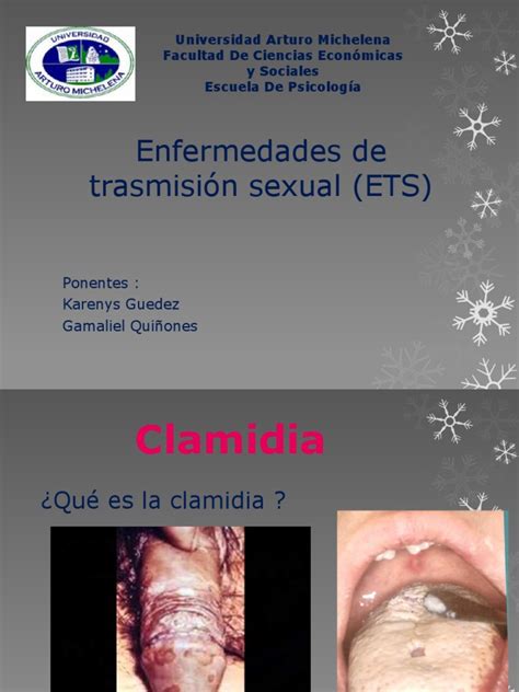 Enfermedades De Trasmisión Sexual Ets