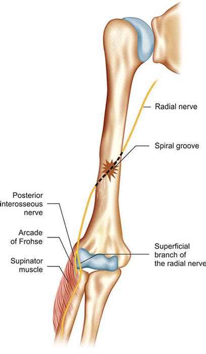 Radial Groove Radial Nerve