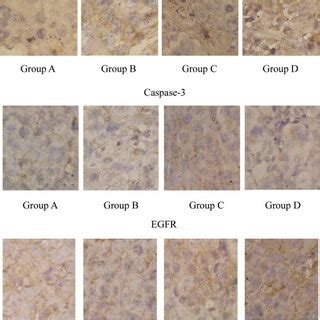 Expression Of Caspase Egfr Tgf Proteins In Tumor Tissue Biopsies