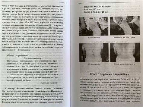 Книга: Жизнь без псориаза. Методика естественного излечения дерматоза и ...