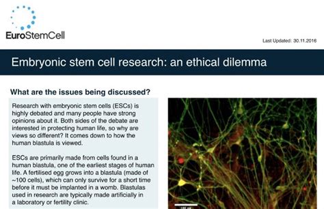 Embryonic Stem Cell Research An Ethical Dilemma